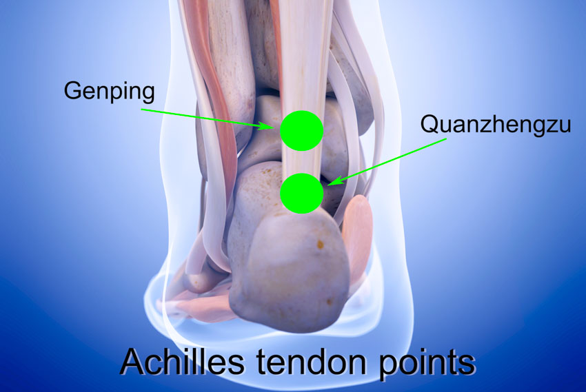 achilles tendon acupuncture