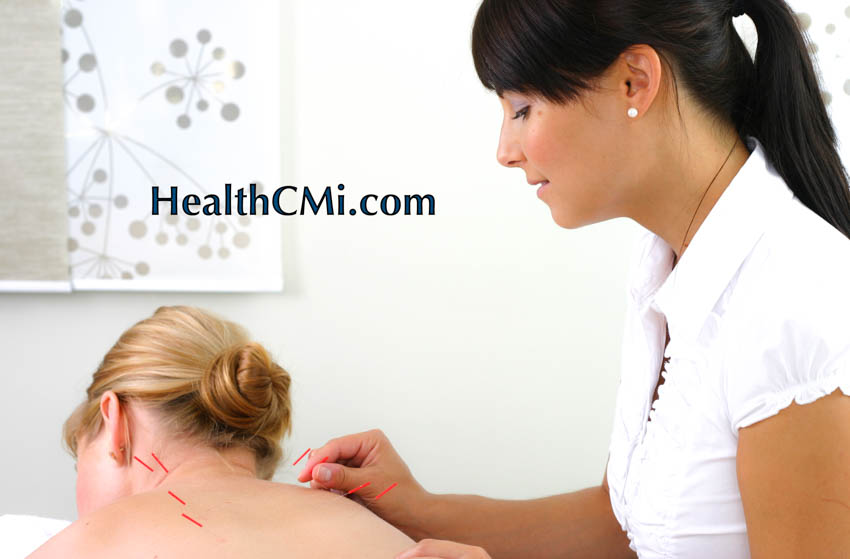 acupuncture ceus sideeffectschemo