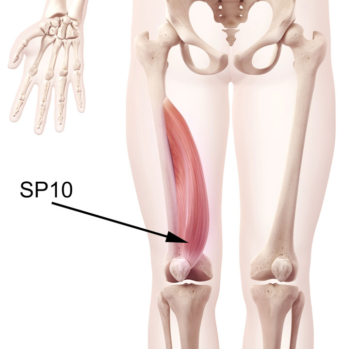 SP10 in the Vastus Medialis