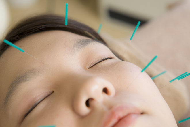 facial needling of a woman