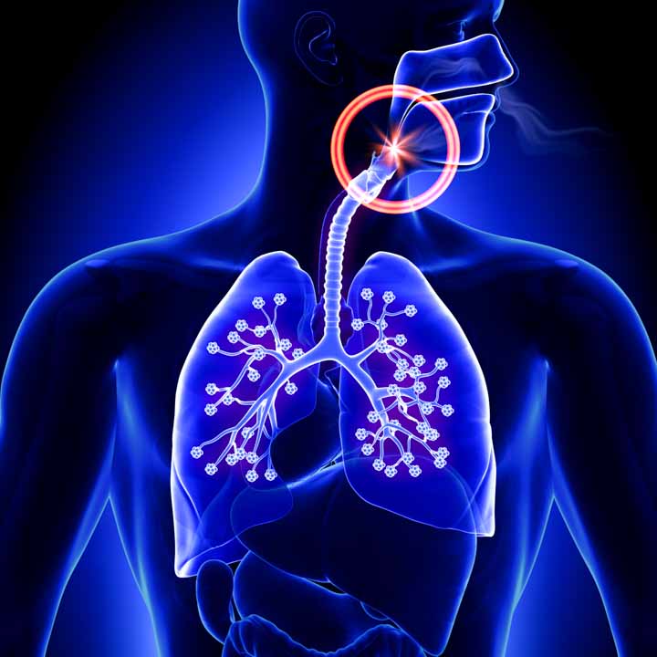 Pictorial of lungs and bronchi.