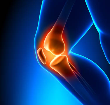 Knee pain shown at the site of the bones. 