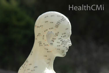 Head acupoints used for treating Wei syndrome. 