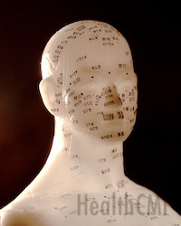 Acupuncture Model