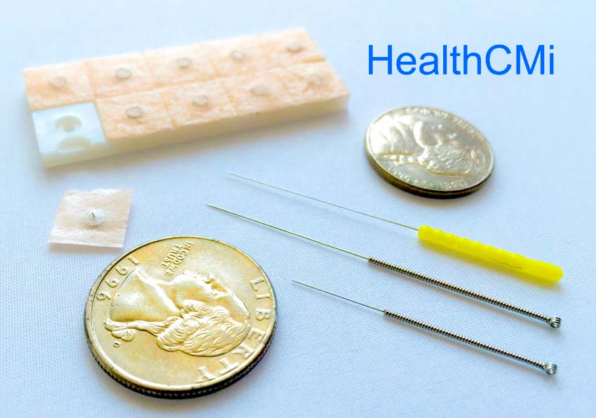 acupuncture needle image