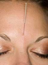 Acupuncture CEU Credit Online