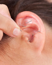 Ear Acupuncture