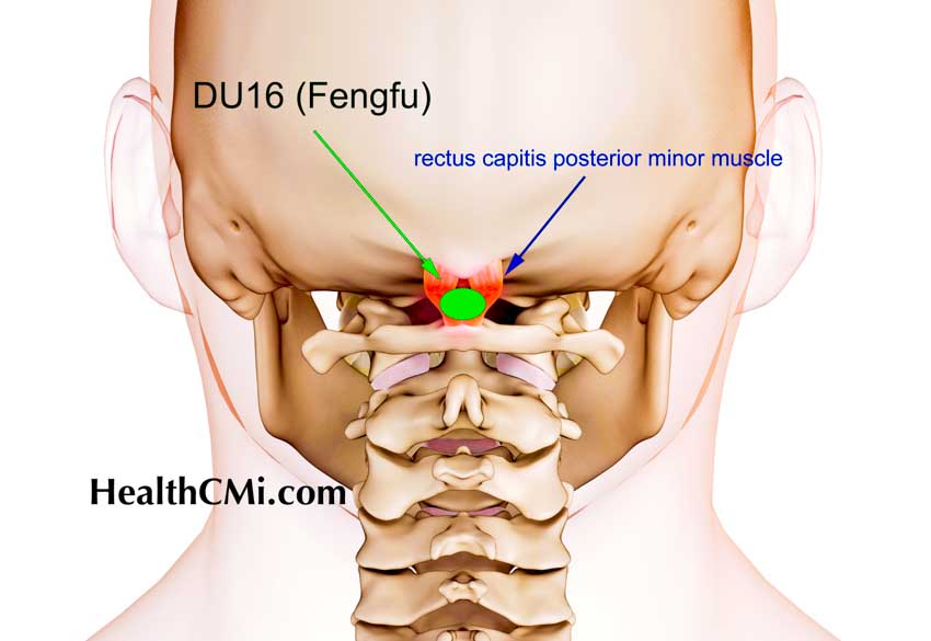 acupuncture gv16 cervicogenicheadache