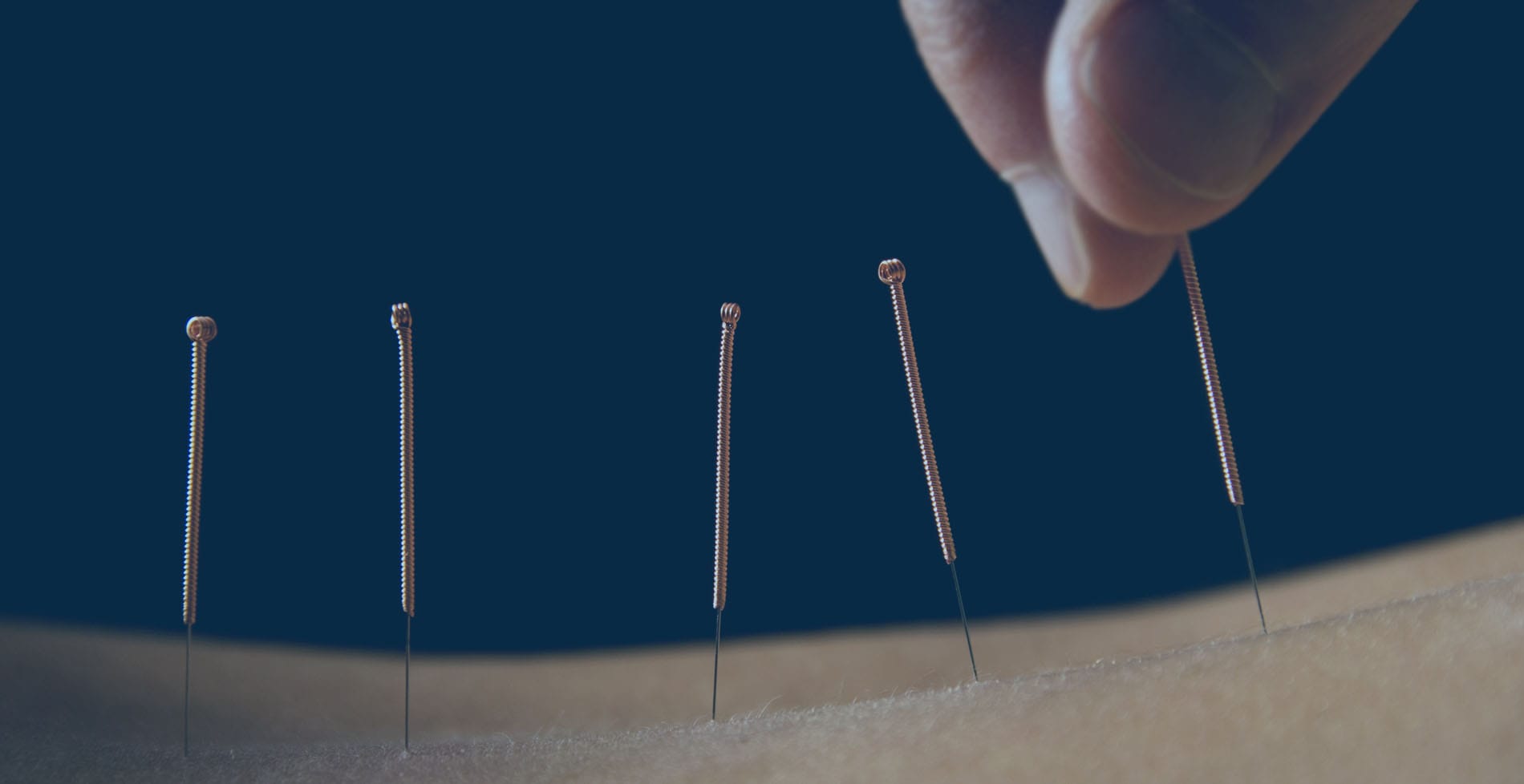 Acupuncture Continuing Ed