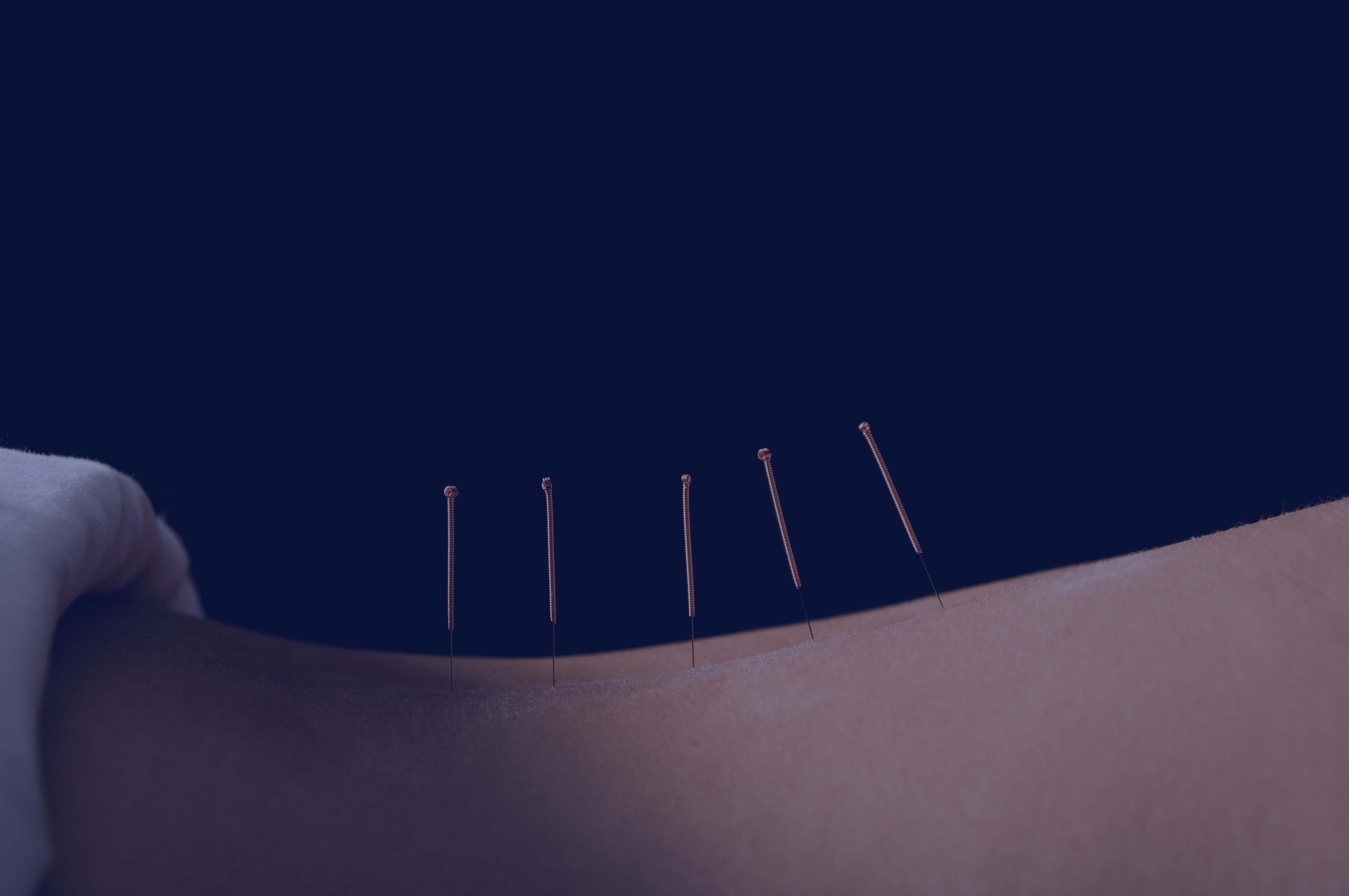 Acupuncture Continuing Education